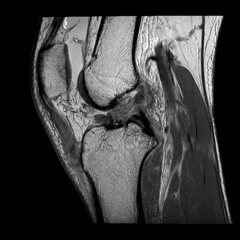 ACL/PCL - Witty, Pask & Buckingham